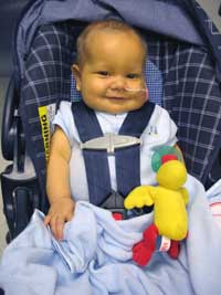Patient with feeding tube.